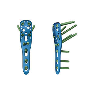 Ορθοπεδική μικρή βίδα πιάτων κλειδώματος τραύματος τεμαχίων